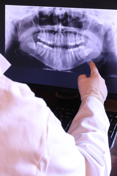 Best Emergency Wisdom Teeth Removal in Amherst, WI